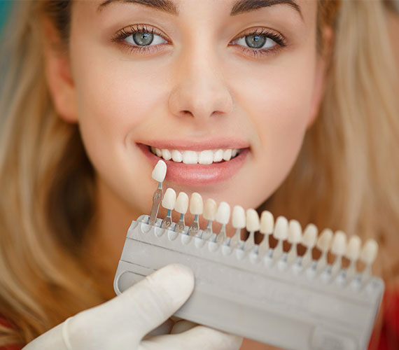 Veneers Treatment Ringwood Dental