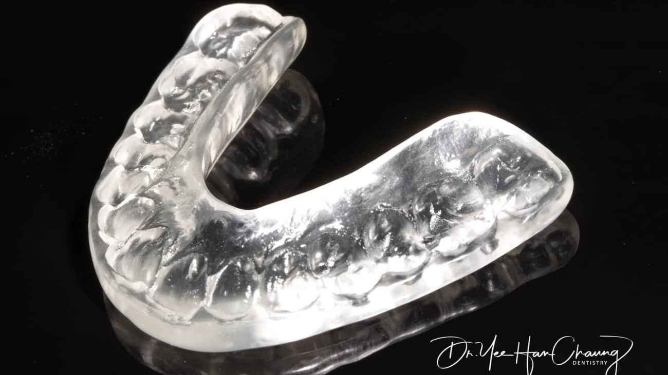 occlusal splint rinwgood