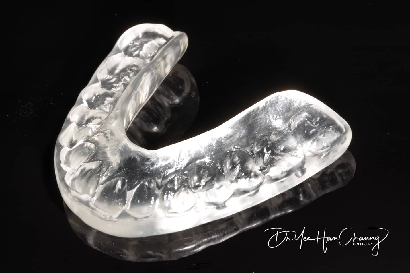 occlusal splint rinwgood
